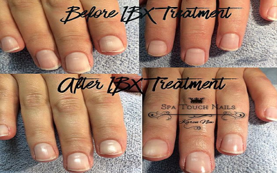 Before and After Treatment